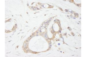 Immunohistochemistry (IHC) image for anti-Ubiquitin Specific Peptidase 5 (USP5) (AA 375-425) antibody (ABIN7449032) (USP5 抗体  (AA 375-425))