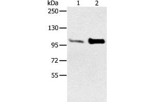 Western Blot analysis of Mouse muscle and heart tissue using ACTN2 Polyclonal Antibody at dilution of 1:300 (ACTN2 抗体)