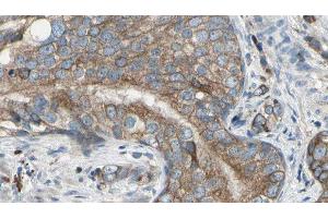 ABIN6277589 at 1/100 staining Human prostate tissue by IHC-P. (CBR1 抗体  (C-Term))
