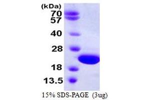 SDS-PAGE (SDS) image for Crystallin, gamma D (CRYGD) (AA 1-174) protein (His tag) (ABIN667535) (CRYGD Protein (AA 1-174) (His tag))