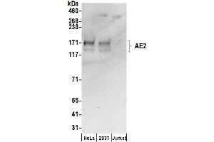 Western Blotting (WB) image for anti-Solute Carrier Family 4, Anion Exchanger, Member 2 (erythrocyte Membrane Protein Band 3-Like 1) (SLC4A2) (AA 1-50) antibody (ABIN7455038)