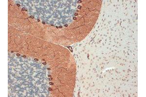 Immunohistochemistry (IHC) image for anti-Inositol 1,4,5-Trisphosphate Receptor, Type 1 (ITPR1) (C-Term) antibody (ABIN6658135)