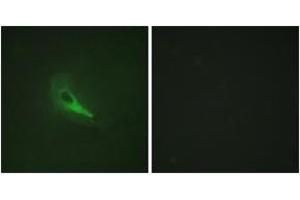 Immunofluorescence analysis of HeLa cells, using AKAP12 Antibody. (AKAP12 抗体  (AA 301-350))