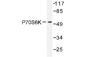 Image no. 1 for anti-Ribosomal Protein S6 Kinase, 70kDa, Polypeptide 1 (RPS6KB1) antibody (ABIN272053) (RPS6KB1 抗体)