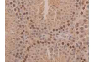 Detection of SOD1 in Rat Testis Tissue using Polyclonal Antibody to Superoxide Dismutase 1 (SOD1) (SOD1 抗体  (AA 2-154))