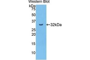 Western blot analysis of the recombinant protein. (CPB2 抗体  (AA 164-417))