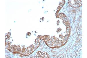 Immunohistochemistry (IHC) image for anti-Calpastatin (CAST) antibody (ABIN6940960)