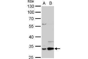 WB Image Annexin V antibody detects ANXA5 protein by Western blot analysis. (Annexin V 抗体)