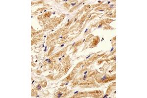 Immunohistochemical analysis of paraffin-embedded H. (ITGB8 抗体  (AA 197-231))