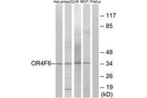 Western blot analysis of extracts from HeLa/Jurkat/HepG2/MCF-7 cells, using OR4F6 Antibody. (OR4F6 抗体  (AA 55-104))