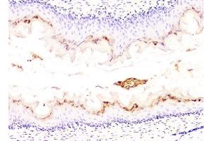 IHC analysis of DHFR using anti-DHFR antibody (ABIN6719418).