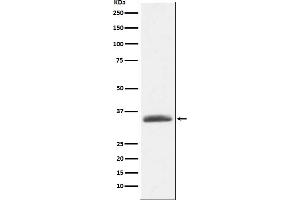 Western Blotting (WB) image for anti-alpha 1 Microglobulin/bikunin precursor (AMBP) antibody (ABIN7606778)