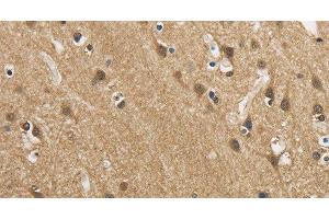 Immunohistochemistry of paraffin-embedded Human brain using GAS7 Polyclonal Antibody at dilution of 1:50 (GAS7 抗体)