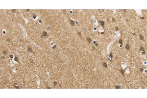 Immunohistochemistry of paraffin-embedded Human brain using GAS7 Polyclonal Antibody at dilution of 1:50