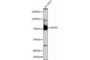 Western blot analysis of extracts of SH-SY5Y cells, using B Rabbit mAb (ABIN7265879) at 1:1000 dilution. (BACE1 抗体)
