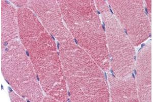 Human Skeletal Muscle: Formalin-Fixed, Paraffin-Embedded (FFPE) (ACTN2 抗体  (AA 11-347))