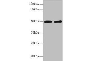 Western blot All lanes: ZBTB25 antibody at 1. (ZBTB25 抗体  (AA 266-435))