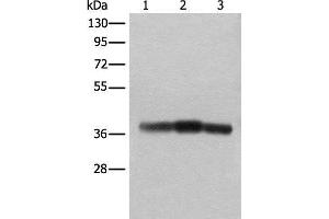 Western blot analysis of Rat brain tissue Mouse brain tissue and Human cerebrum tissue lysates using ATAD1 Polyclonal Antibody at dilution of 1:800 (ATAD1 抗体)