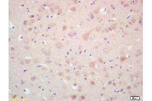 Formalin-fixed and paraffin embedded rat brain labeled with Rabbit Anti MAP LC3 Beta Polyclonal Antibody, Unconjugated (ABIN1386128) at 1:200 followed by conjugation to the secondary antibody and DAB staining (MAP1LC3A/B 抗体  (AA 25-121))