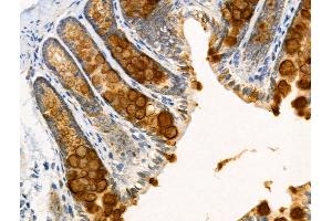 ABIN6258661 and ABIN6274799 at 1/100 staining Rat stomach tissue by IHC-P. (ACSS2 抗体  (N-Term))