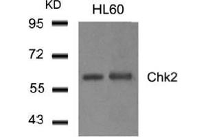 Western blot analysis of extract from HL60 cells using Chk2. (CHEK2 抗体  (AA 514-518))