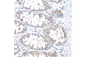 Immunohistochemistry of paraffin-embedded human colon using HSD17B10 antibody. (HSD17B10 抗体  (AA 1-261))