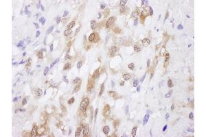 Immunohistochemistry (IHC) image for anti-Superoxide Dismutase 1, Soluble (SOD1) (AA 54-104) antibody (ABIN7453945) (SOD1 抗体  (AA 54-104))