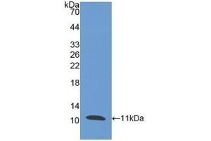 Detection of Recombinant PI3, Human using Polyclonal Antibody to Peptidase Inhibitor 3, Skin Derived (PI3) (PI3 抗体  (AA 41-117))