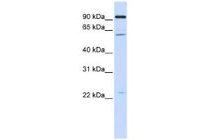 CDC45L antibody used at 1 ug/ml to detect target protein. (CDC45 抗体)