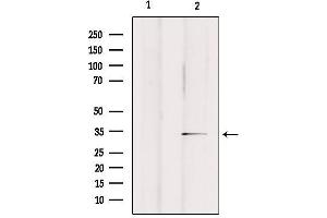 Western Blotting (WB) image for anti-Olfactory Receptor, Family 2, Subfamily A, Member 25 (OR2A25) antibody (ABIN6263848)