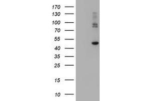 Image no. 2 for anti-Carboxypeptidase A2 (Pancreatic) (CPA2) antibody (ABIN1497595) (Carboxypeptidase A2 抗体)
