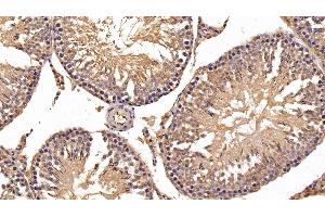 Detection of HK1 in Rat Testis Tissue using Polyclonal Antibody to Hexokinase 1 (HK1) (Hexokinase 1 抗体  (AA 80-215))