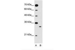 Image no. 2 for anti-Solute Carrier Family 25 (Mitochondrial Carrier: Glutamate), Member 22 (SLC25A22) (AA 131-180) antibody (ABIN205021) (SLC25A22 抗体  (AA 131-180))