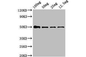 Western Blot Positive WB detected in Recombinant protein All lanes: NIPBL antibody at 4 μg/mL Secondary Goat polyclonal to rabbit IgG at 1/50000 dilution predicted band size: 50 kDa observed band size: 50 kDa (NIPBL 抗体  (AA 2523-2697))