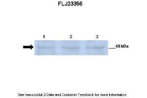 Lanes:   Lane 1: 30ug mouse renal epithelial lysate Lane 2: 30ug mouse renal epithelial lysate Lane 3: 30ug mouse renal epithelial lysate  Primary Antibody Dilution:   1:500  Secondary Antibody:   Anti-rabbit-HRP  Secondary Antibody Dilution:   1:2500  Gene Name:   FLJ23356  Submitted by:   Dr. (SGK196 抗体  (N-Term))