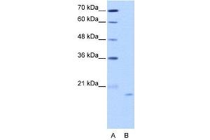 WB Suggested Anti-NOL6  Antibody Titration: 2. (Nucleolar Protein 6 抗体  (C-Term))