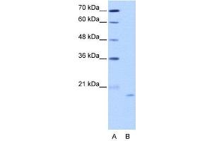 WB Suggested Anti-NOL6  Antibody Titration: 2.
