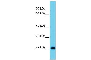Host: Rabbit  Target Name: Rala  Sample Tissue: Rat Stomach lysates  Antibody Dilution: 1. (rala 抗体  (N-Term))