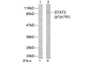 Image no. 2 for anti-Signal Transducer and Activator of Transcription 3 (Acute-Phase Response Factor) (STAT3) (pTyr705) antibody (ABIN196691) (STAT3 抗体  (pTyr705))