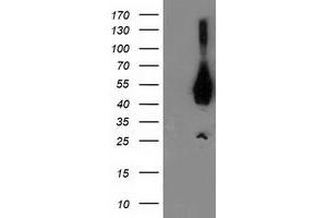 Western Blotting (WB) image for anti-Activating Signal Cointegrator 1 Complex Subunit 1 (ASCC1) antibody (ABIN1496743) (ASCC1 抗体)