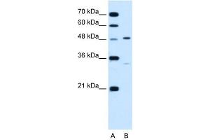 CHST1 antibody used at 1. (CHST1 抗体)