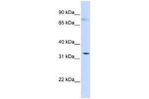 WB Suggested Anti-SIGLEC6 Antibody Titration:  0. (SIGLEC6 抗体  (N-Term))