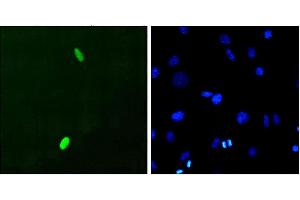 Immunocytochemistry/Immunofluorescence analysis using Mouse Anti-DUX4 Monoclonal Antibody, Clone P2B1 . (DUX4 抗体  (C-Term) (Biotin))