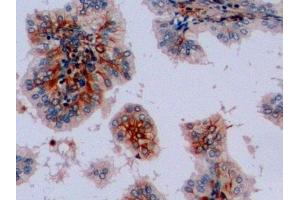 Detection of VIM in Human Prostate Tissue using Polyclonal Antibody to Vimentin (VIM) (Vimentin 抗体  (AA 2-466))