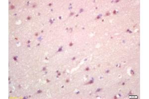 Formalin-fixed and paraffin embedded human brain labeled with Anti-CCBR1 Polyclonal Antibody, Unconjugated (ABIN872924) at 1:200 followed by conjugation to the secondary antibody and DAB staining