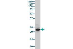 C13orf1 monoclonal antibody (M01), clone 2G4 Western Blot analysis of C13orf1 expression in PC-12 . (CLLD6 抗体  (AA 97-196))