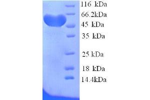 SDS-PAGE (SDS) image for Hemopexin (HPX) (AA 24-460), (full length) protein (His tag) (ABIN7479084)