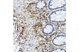 Immunohistochemistry of paraffin-embedded human colon using CD90/Thy1 Rabbit mAb (ABIN6129735, ABIN6148554, ABIN6148555 and ABIN7101405) at dilution of 1:100 (40x lens). (CD90 抗体)