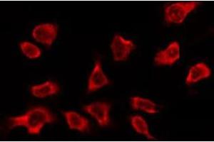 ABIN6278605 staining Hela by IF/ICC. (OR2A5/2A14 抗体)