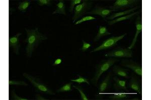Immunofluorescence of monoclonal antibody to ZIC3 on HeLa cell. (ZIC3 抗体  (AA 182-274))
